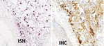 SARS Coronavirus Nucleocapsid Antibody in Immunohistochemistry (Paraffin) (IHC (P))