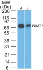 PRMT7 Polyclonal Antibody