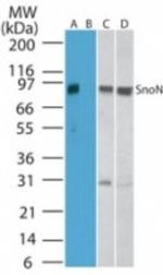 SnoN Polyclonal Antibody