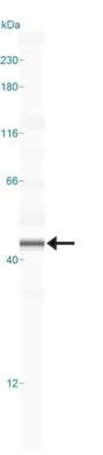 CCR5 Polyclonal Antibody