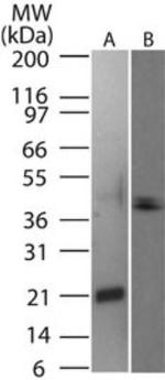 CD254 (RANK Ligand) Antibody in Western Blot (WB)