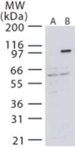NIK Antibody in Western Blot (WB)