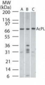 IL18RAP Antibody in Western Blot (WB)