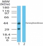 FNTA Antibody in Western Blot (WB)