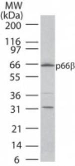 GATAD2B Polyclonal Antibody