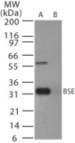 PrP Polyclonal Antibody