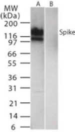 SARS Coronavirus Spike Protein Antibody in Western Blot (WB)
