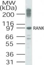 RANK Polyclonal Antibody