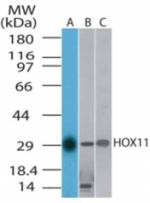 HOXA11 Polyclonal Antibody