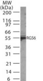RGS6 Polyclonal Antibody