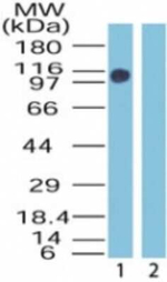 ZMYM2 Antibody in Western Blot (WB)