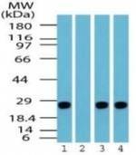 PGP9.5 Antibody in Western Blot (WB)