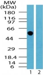 TRK fused gene Antibody in Western Blot (WB)