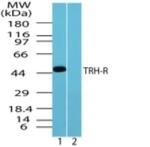 TRHR Antibody in Western Blot (WB)