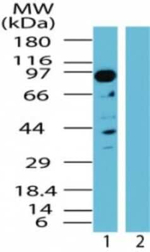 TAB3 Polyclonal Antibody