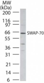 SWAP70 Polyclonal Antibody