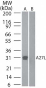 Smallpox Virus A27L Polyclonal Antibody