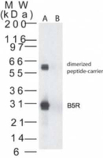 Smallpox Virus B5R Polyclonal Antibody