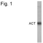 SERPINA3 Polyclonal Antibody