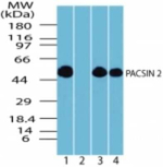 PACSIN2 Antibody in Western Blot (WB)
