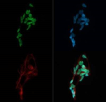 MTA2 Polyclonal Antibody