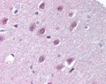 Importin 9 Polyclonal Antibody