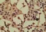 Importin 8 Polyclonal Antibody