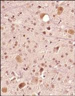 FAM3C Antibody in Immunohistochemistry (Paraffin) (IHC (P))