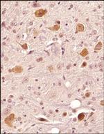 FAM3C Polyclonal Antibody