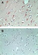 FAM3C Antibody in Immunohistochemistry (Paraffin) (IHC (P))