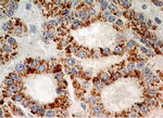 XPO4 Polyclonal Antibody