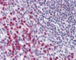 BCLAF1 Antibody in Immunohistochemistry (Paraffin) (IHC (P))