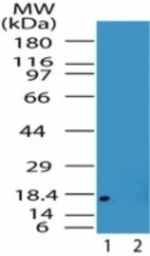 Acid Phosphatase 1 Polyclonal Antibody