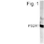 RDH11 Polyclonal Antibody