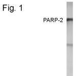 PARP2 Antibody in Western Blot (WB)