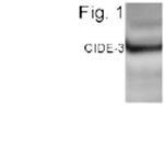 CIDEC Polyclonal Antibody