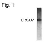BRCAA1 Polyclonal Antibody