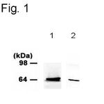 PINK1 Polyclonal Antibody