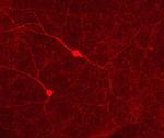 Phospho-Tyrosine Hydroxylase (Ser31) Antibody in Immunocytochemistry (ICC/IF)