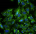 ALOX5 Polyclonal Antibody