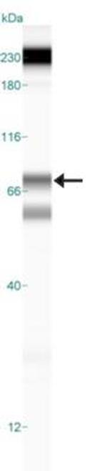 ALOX5 Antibody in Western Blot (WB)