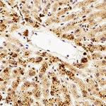 TMP21 Polyclonal Antibody