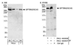 Spectrin beta-3 Antibody in Western Blot (WB)