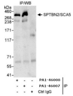 Spectrin beta-3 Antibody in Immunoprecipitation (IP)