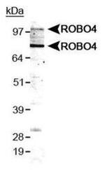 ROBO4 Antibody in Western Blot (WB)