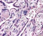 ROBO4 Antibody in Immunohistochemistry (IHC)