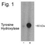 Phospho-Tyrosine Hydroxylase (Ser31) Antibody in Western Blot (WB)