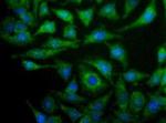 NOX4 Antibody in Immunocytochemistry (ICC/IF)
