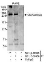 CIC Antibody in Immunoprecipitation (IP)