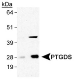 PTGDS Polyclonal Antibody